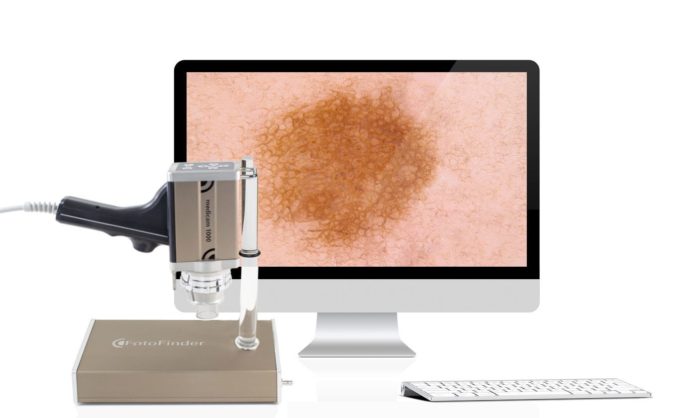 Video dermatoscope / LED / hand-held