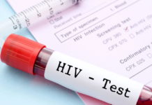 Hiv a Latina, la settimana dei test gratuiti e anonimi si chiude sabato