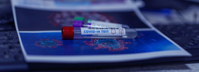 coronavirus test
