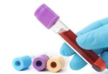 Sangue infetto, 700mila euro alla famiglia della vittima deceduta