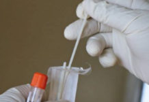 Covid, sono 153 i nuovi casi accertati in Provincia