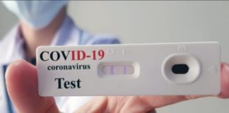 Tamponi gratis dal medico di base, la proroga della Regione