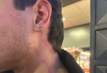 Sezze, studente rapinato e aggredito in stazione