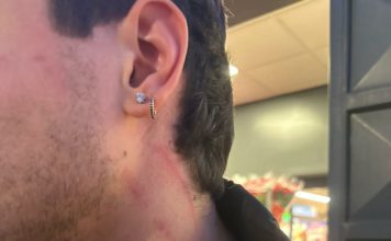 Sezze, studente rapinato e aggredito in stazione