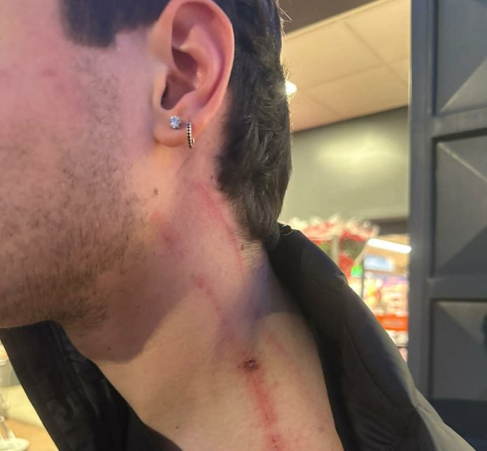 Studente aggredito Sezze